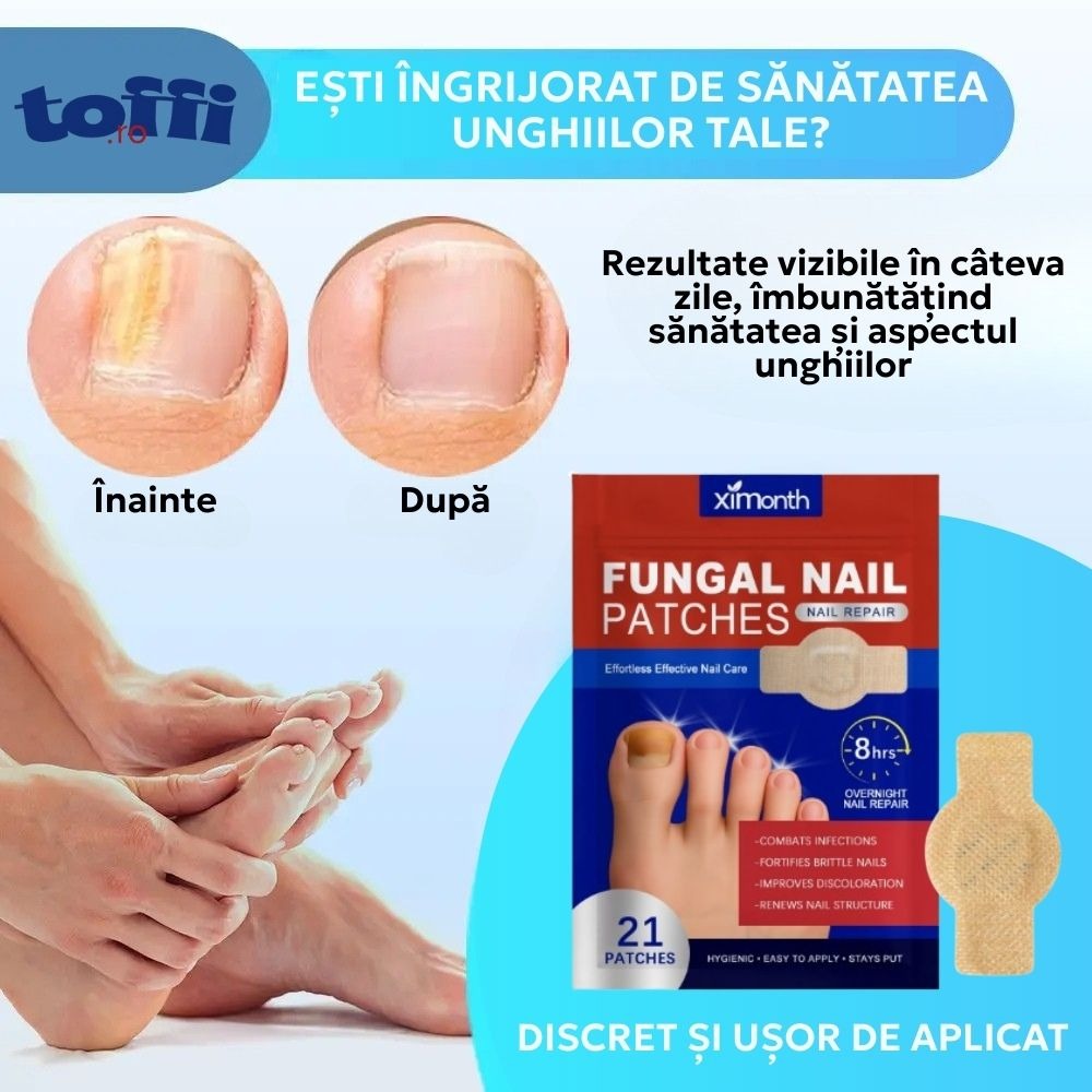 Plasturi Antibacterieni & Antifungici pentru Unghii